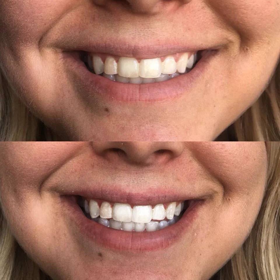 Beaut Cozy Smile Kit *FINAL SALE*